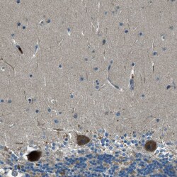 Invitrogen MLSTD2 Polyclonal Antibody 100 &mu;L; Unconjugated:Antibodies,