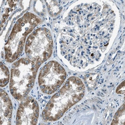 Invitrogen MLSTD2 Polyclonal Antibody 100 &mu;L; Unconjugated:Antibodies,