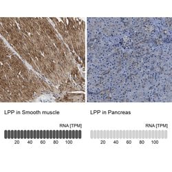 Invitrogen LPP Polyclonal Antibody 100 &mu;L; Unconjugated:Antibodies,