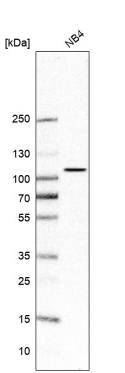 Invitrogen PALD1 Polyclonal Antibody 100 &mu;L; Unconjugated:Anticuerpos