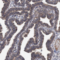 Invitrogen ITIH3 Polyclonal Antibody 100 &mu;L; Unconjugated:Antibodies,