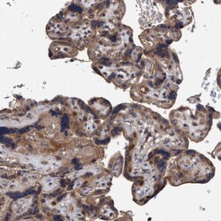 Invitrogen ITIH3 Polyclonal Antibody 100 &mu;L; Unconjugated:Antibodies,