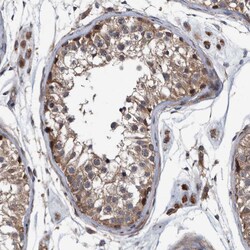 Invitrogen ITIH3 Polyclonal Antibody 100 &mu;L; Unconjugated:Antibodies,