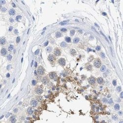 Invitrogen TSGA2 Polyclonal Antibody 100 &mu;L; Unconjugated:Antibodies,