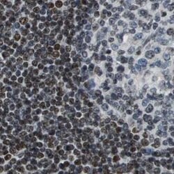 Invitrogen SP100 Polyclonal Antibody 100 &mu;L | Buy Online | Invitrogen&trade; | Fisher Scientific