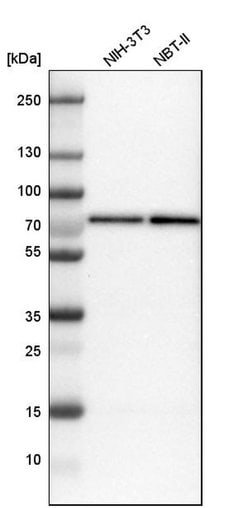 Invitrogen CTPS2 Polyclonal Antibody 100 &mu;L; Unconjugated:Antibodies,