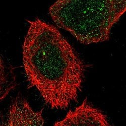 Invitrogen CHST15 Polyclonal Antibody 100 &mu;L; Unconjugated:Antibodies,