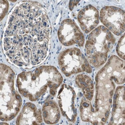 Invitrogen FAM73A Polyclonal Antibody 100 &mu;L; Unconjugated:Antibodies,