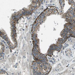 Invitrogen FAM73A Polyclonal Antibody 100 &mu;L; Unconjugated:Antibodies,