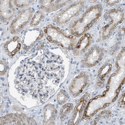 Invitrogen MRS2 Polyclonal Antibody 100 &mu;L; Unconjugated:Antibodies,