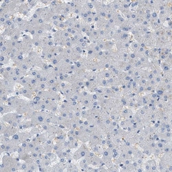 Invitrogen MRS2 Polyclonal Antibody 100 &mu;L; Unconjugated:Antibodies,