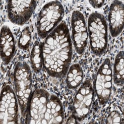 Invitrogen CLEC2D Polyclonal Antibody 100 &mu;L; Unconjugated:Antibodies,