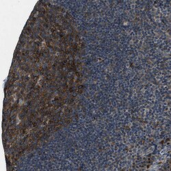 Invitrogen CLEC2D Polyclonal Antibody 100 &mu;L; Unconjugated:Antibodies,