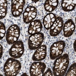Invitrogen CNNM4 Polyclonal Antibody 100 &mu;L; Unconjugated:Antibodies,