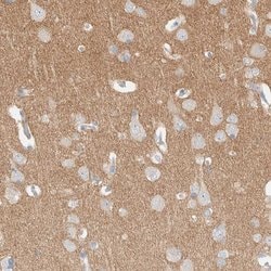 Invitrogen ATCAY Polyclonal Antibody 100 &mu;L; Unconjugated:Antibodies,
