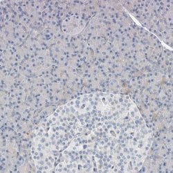 Invitrogen ATCAY Polyclonal Antibody 100 &mu;L; Unconjugated:Antibodies,