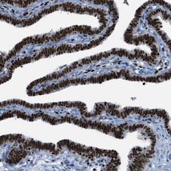 Invitrogen SLFN5 Polyclonal Antibody 100 &mu;L; Unconjugated:Antibodies,