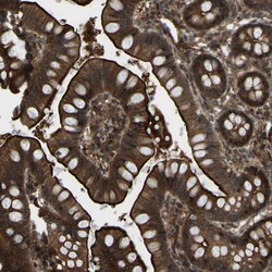 Invitrogen CYP7B1 Polyclonal Antibody 100 &mu;L; Unconjugated:Antibodies,
