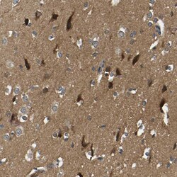 Invitrogen NDRG3 Polyclonal Antibody 100 &mu;L; Unconjugated:Antibodies,