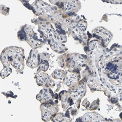 Invitrogen NDRG3 Polyclonal Antibody 100 &mu;L; Unconjugated:Antibodies,