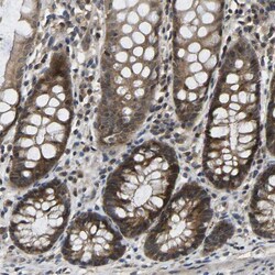Invitrogen NDRG3 Polyclonal Antibody 100 &mu;L; Unconjugated:Antibodies,