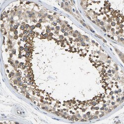 Invitrogen NDRG3 Polyclonal Antibody 100 &mu;L; Unconjugated:Antibodies,