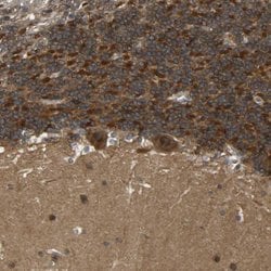 Invitrogen NDRG3 Polyclonal Antibody 100 &mu;L; Unconjugated:Antibodies,