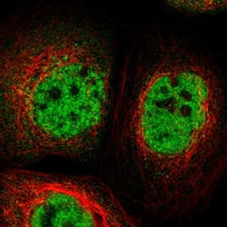 Invitrogen TOX4 Polyclonal Antibody 100 &mu;L; Unconjugated:Antibodies,