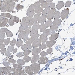 SLC36A4 Polyclonal Antibody:Antibodies, Polyclonal