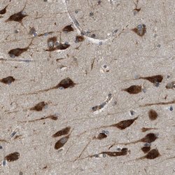 SLC36A4 Polyclonal Antibody:Antibodies, Polyclonal