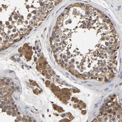 Invitrogen STK32C Polyclonal Antibody 100 &mu;L; Unconjugated:Antibodies,