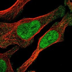 Invitrogen OGFR Polyclonal Antibody 100 &mu;L; Unconjugated:Antibodies,