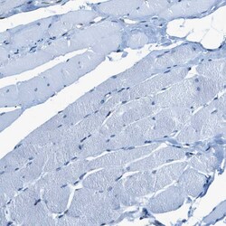 Invitrogen OGFR Polyclonal Antibody 100 &mu;L; Unconjugated:Antibodies,