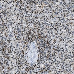 Invitrogen OGFR Polyclonal Antibody 100 &mu;L; Unconjugated:Antibodies,