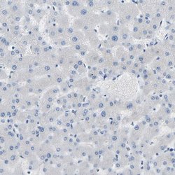 Invitrogen COL15A1 Polyclonal Antibody 100 &mu;L; Unconjugated:Antibodies,