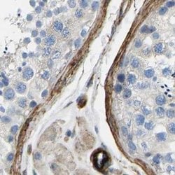 Invitrogen COL15A1 Polyclonal Antibody 100 &mu;L; Unconjugated:Antibodies,