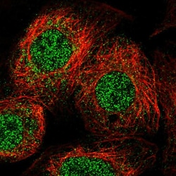 Invitrogen ULK4 Polyclonal Antibody 100 &mu;L; Unconjugated:Antibodies,