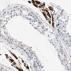 Invitrogen ULK4 Polyclonal Antibody 100 &mu;L; Unconjugated:Antibodies,
