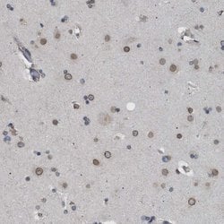 Invitrogen NUP93 Polyclonal Antibody 100 &mu;L; Unconjugated:Antibodies,