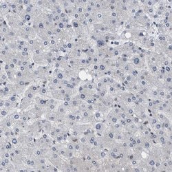 Invitrogen NUP93 Polyclonal Antibody 100 &mu;L; Unconjugated:Antibodies,