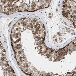 Invitrogen NUP93 Polyclonal Antibody 100 &mu;L; Unconjugated:Antibodies,
