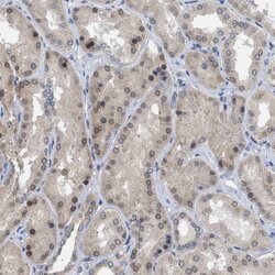 Invitrogen NUP93 Polyclonal Antibody 100 &mu;L; Unconjugated:Antibodies,