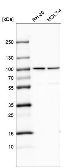 Invitrogen NUP93 Polyclonal Antibody 100 &mu;L; Unconjugated:Antibodies,