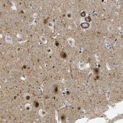 Invitrogen LRRC8B Polyclonal Antibody 100 &mu;L | Buy Online | Invitrogen&trade; | Fisher Scientific