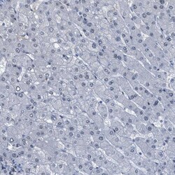 Invitrogen LRRC8B Polyclonal Antibody 100 &mu;L | Buy Online | Invitrogen&trade; | Fisher Scientific