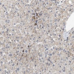 Invitrogen PALMD Polyclonal Antibody 100 &mu;L; Unconjugated:Antibodies,