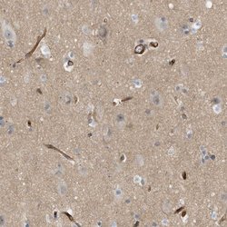 Invitrogen PALMD Polyclonal Antibody 100 &mu;L; Unconjugated:Antibodies,
