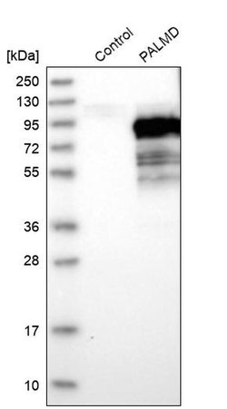 Invitrogen PALMD Polyclonal Antibody 100 &mu;L; Unconjugated:Antibodies,