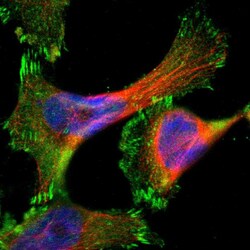 Invitrogen Coronin 2B Polyclonal Antibody 100 &mu;L; Unconjugated:Antibodies,