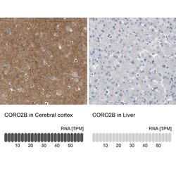 Invitrogen Coronin 2B Polyclonal Antibody 100 &mu;L; Unconjugated:Antibodies,